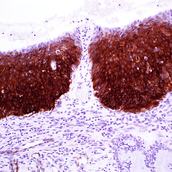 Heat Shock Protein 27