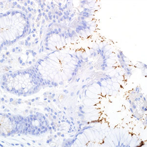 Helicobacter pylori