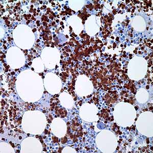 Hemoglobin A