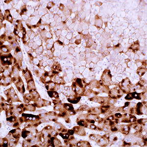 Hepatitis B Virus Surface Antigen