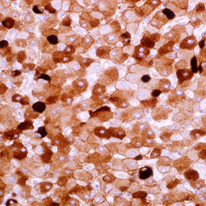 Hepatitis B Virus Surface Antigen