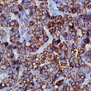 Hepatocyte Specific Antigen