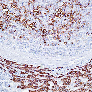 Hepatocyte Specific Antigen