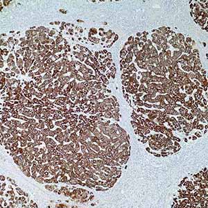 Hepatocyte Specific Antigen