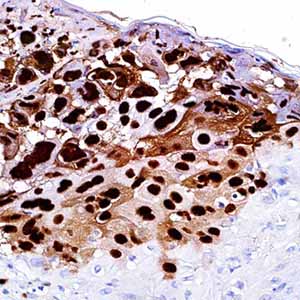 Herpes Simplex Virus I, 10A3, mouse
