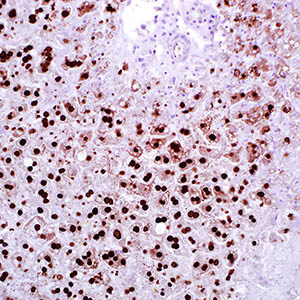 Herpes Simplex Virus I, 10A3, mouse