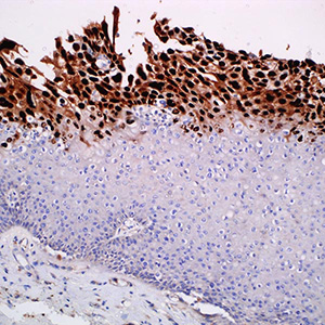 Herpes Simplex Virus I, 10A3, mouse