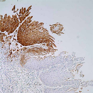 Herpes Simplex Virus I, polyclonal, rabbit