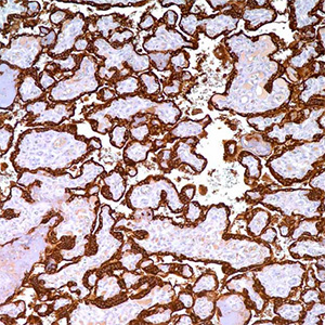 Human Placental Lactogen (hPL)