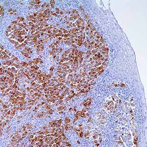 Mart-1 (Melan A), M2-7C10, mouse