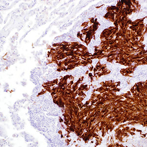 Mart-1 (Melan A), M2-7C10, mouse