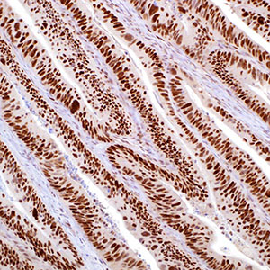 MSH6, 44, mouse
