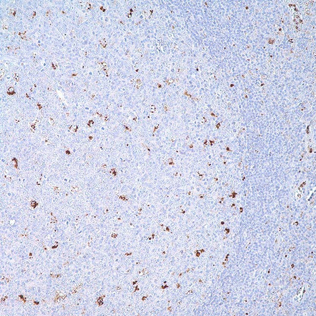 A-1-Antichymotrypsin