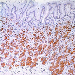 MUC6