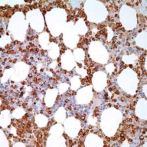 Myeloperoxidase, polyclonal, rabbit