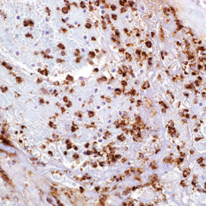 Myeloperoxidase, polyclonal, rabbit