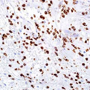 Myeloperoxidase, SP72, rabbit