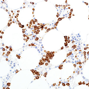 Myeloperoxidase, SP72, rabbit