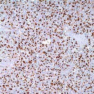 Myogenin