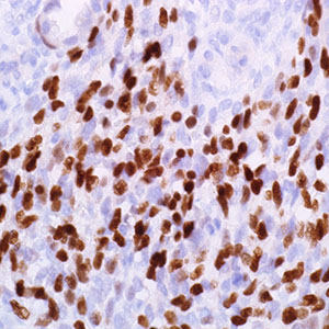 Myogenin
