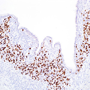 Myogenin