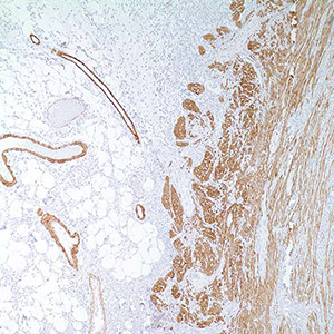 Myosin, Smooth Muscle