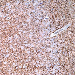 Neurofilament