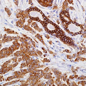 p120/catenin