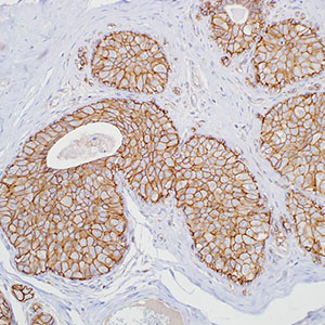 p120/catenin