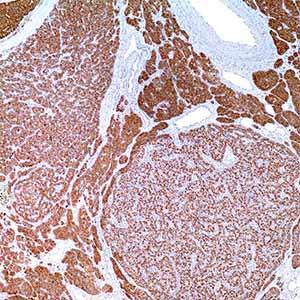 Parathyroid Hormone