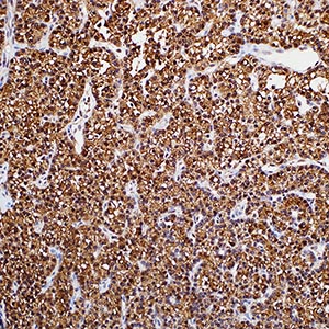 Parathyroid Hormone