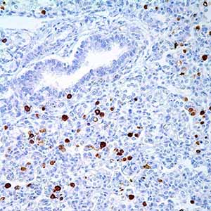 Parvovirus B19