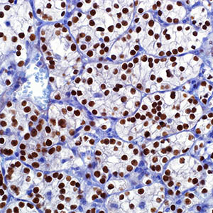 Pax-8, polyclonal, rabbit