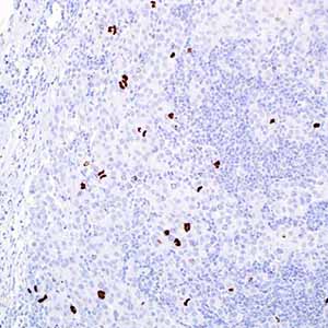 Phosphohistone H3 (PHH3)
