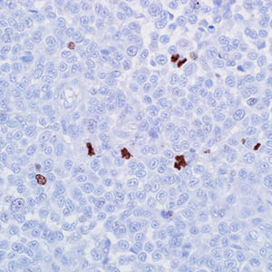 Phosphohistone H3 (PHH3)