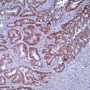 PMS2, EPR3947, rabbit