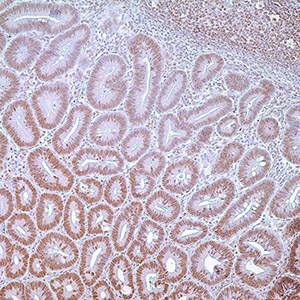 PMS2, EPR3947, rabbit