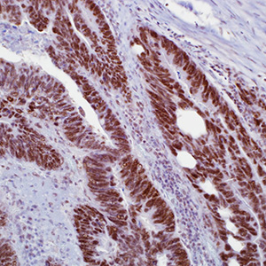PMS2, EPR3947, rabbit