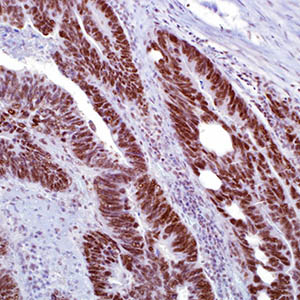 PMS2, MRQ-28, mouse
