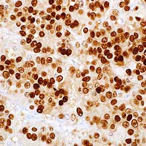 Progesteron Receptor, SP42, rabbit