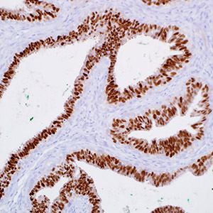 Progesteron Receptor, SP42, rabbit