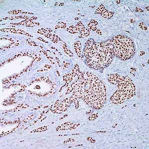 Progesteron Receptor, Y85, rabbit