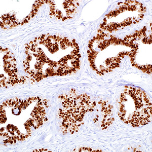 Progesteron Receptor, Y85, rabbit