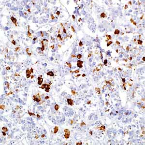 Prolactin