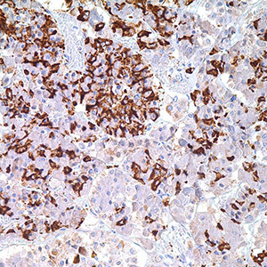 Prolactin