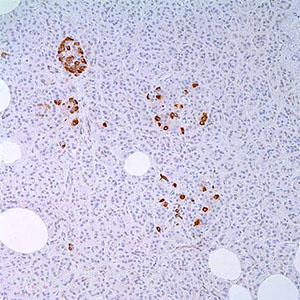 Somatostatin