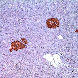 Synaptophysin, MRQ-40, rabbit