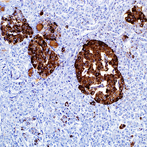 Synaptophysin, MRQ-40, rabbit