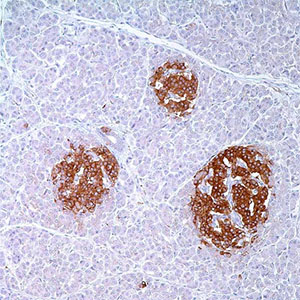 Synaptophysin, polyclonal, rabbit