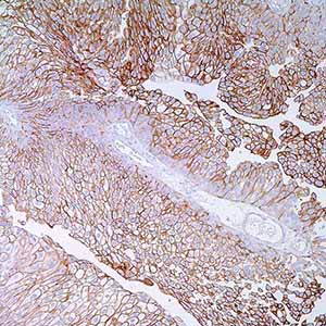 Thrombomodulin